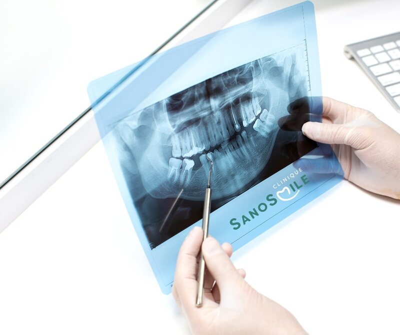 Sano Smile - Clinica stomatologie Bucuresti